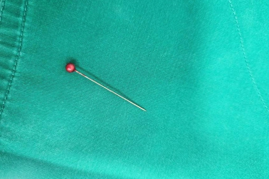 Kim may đâm sâu vào phế quản bé trai 13 tháng tuổi - 2 Kim may đâm sâu vào phế quản bé trai 13 tháng tuổi - 2