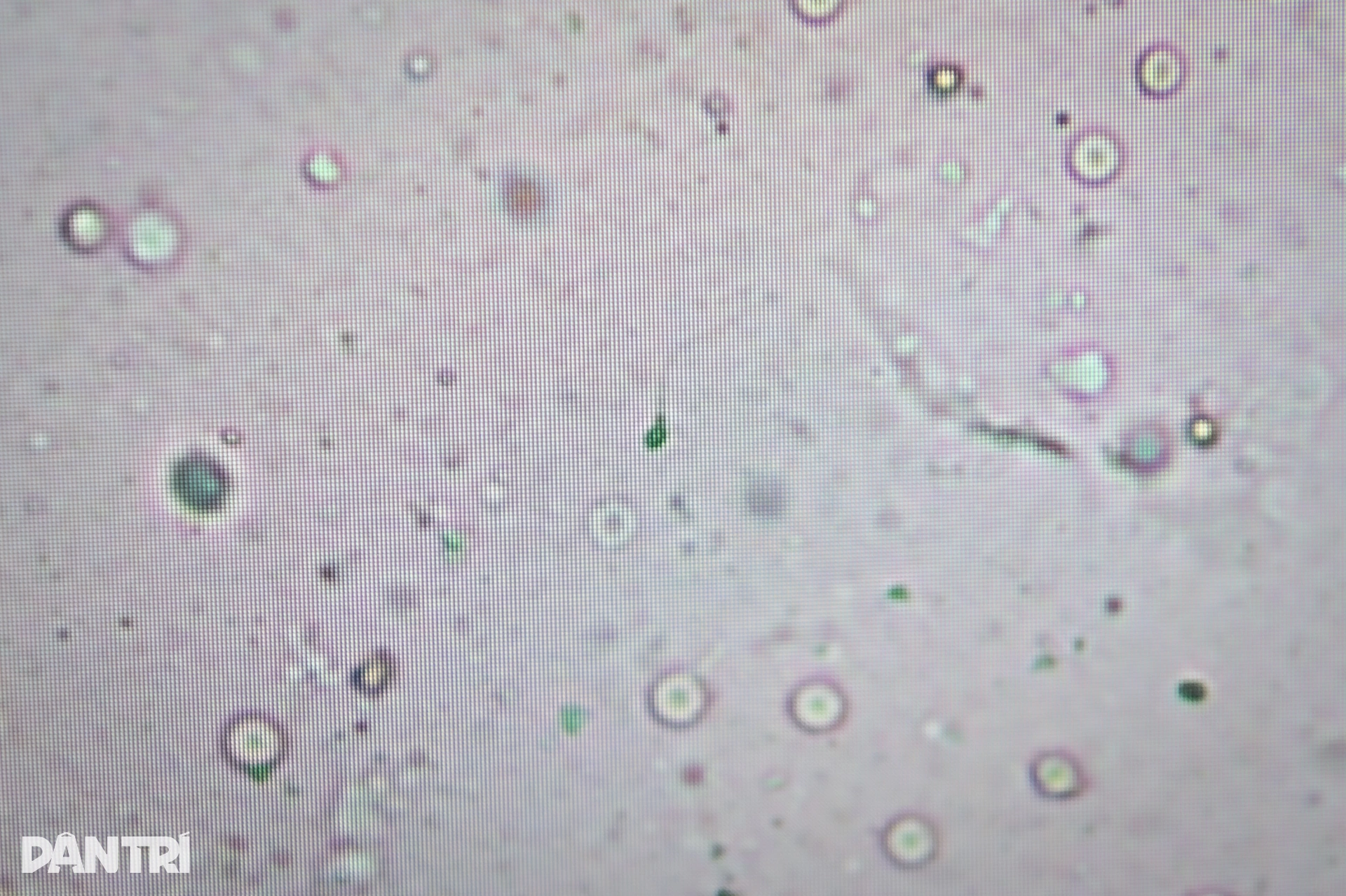 Một giờ săn lùng những tinh binh cuối cùng của người đàn ông 10 năm vô sinh - 13