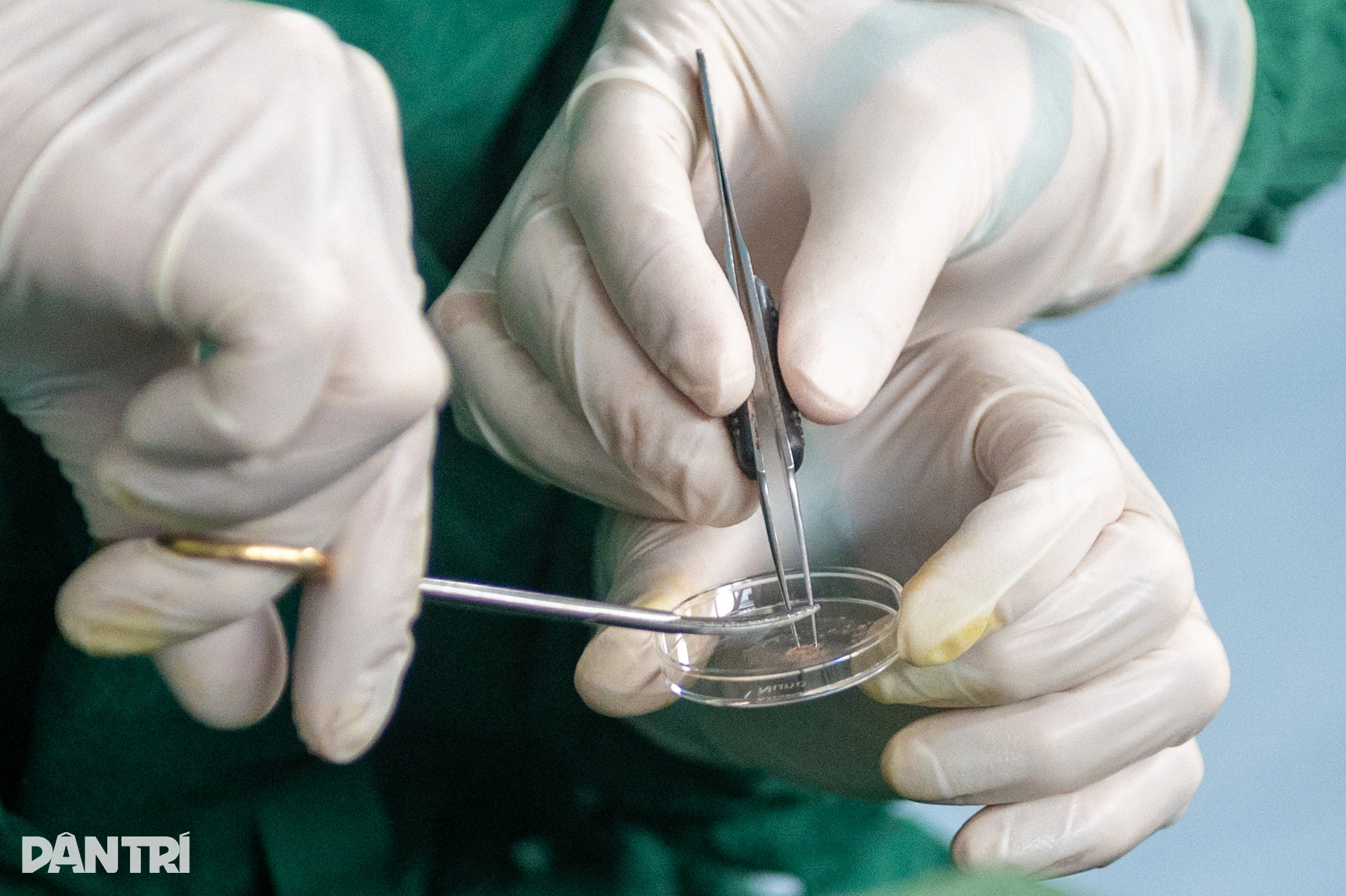 Một giờ săn lùng những tinh binh cuối cùng của người đàn ông 10 năm vô sinh - 10