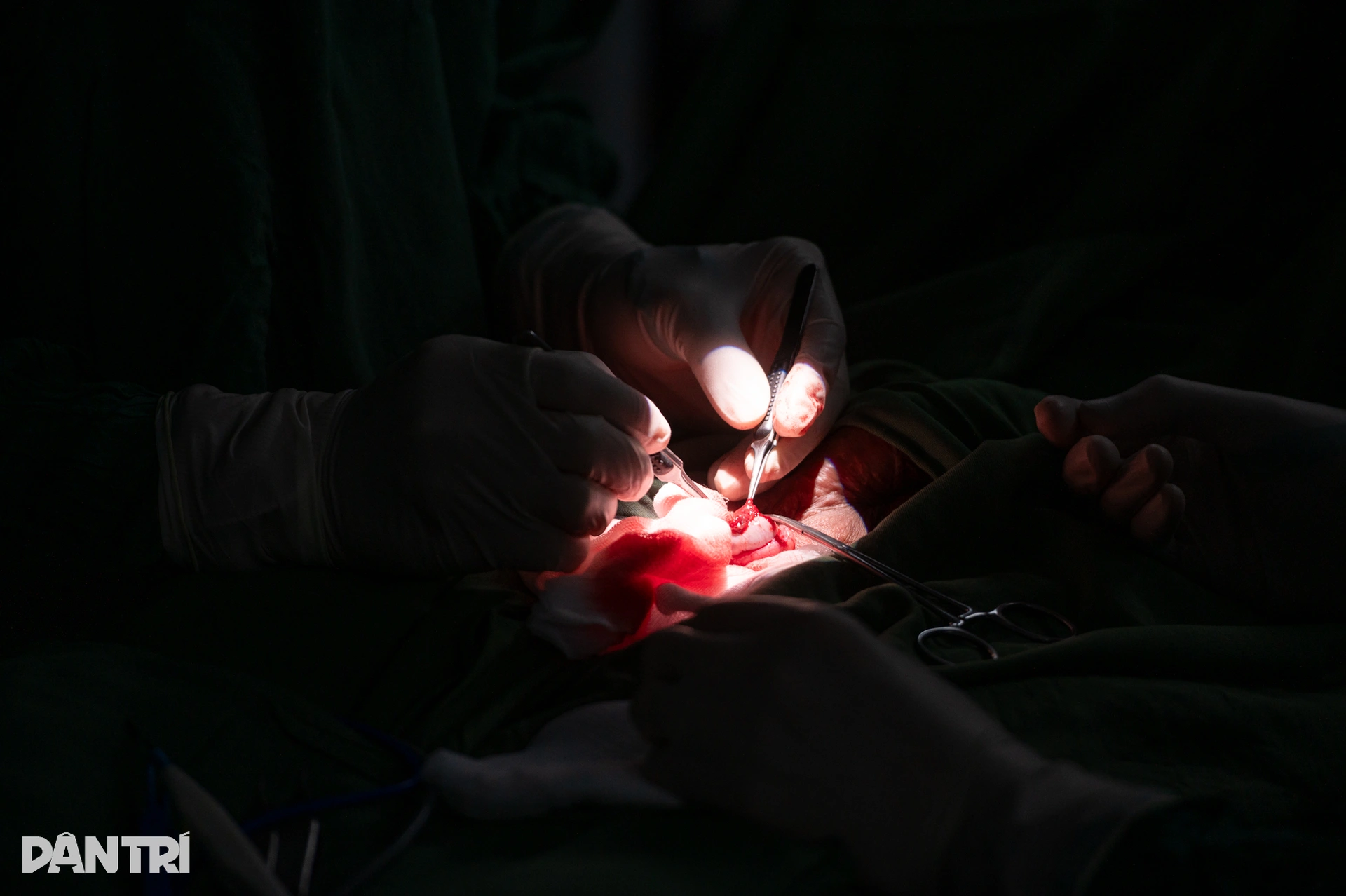 Một giờ săn lùng những tinh binh cuối cùng của người đàn ông 10 năm vô sinh - 8