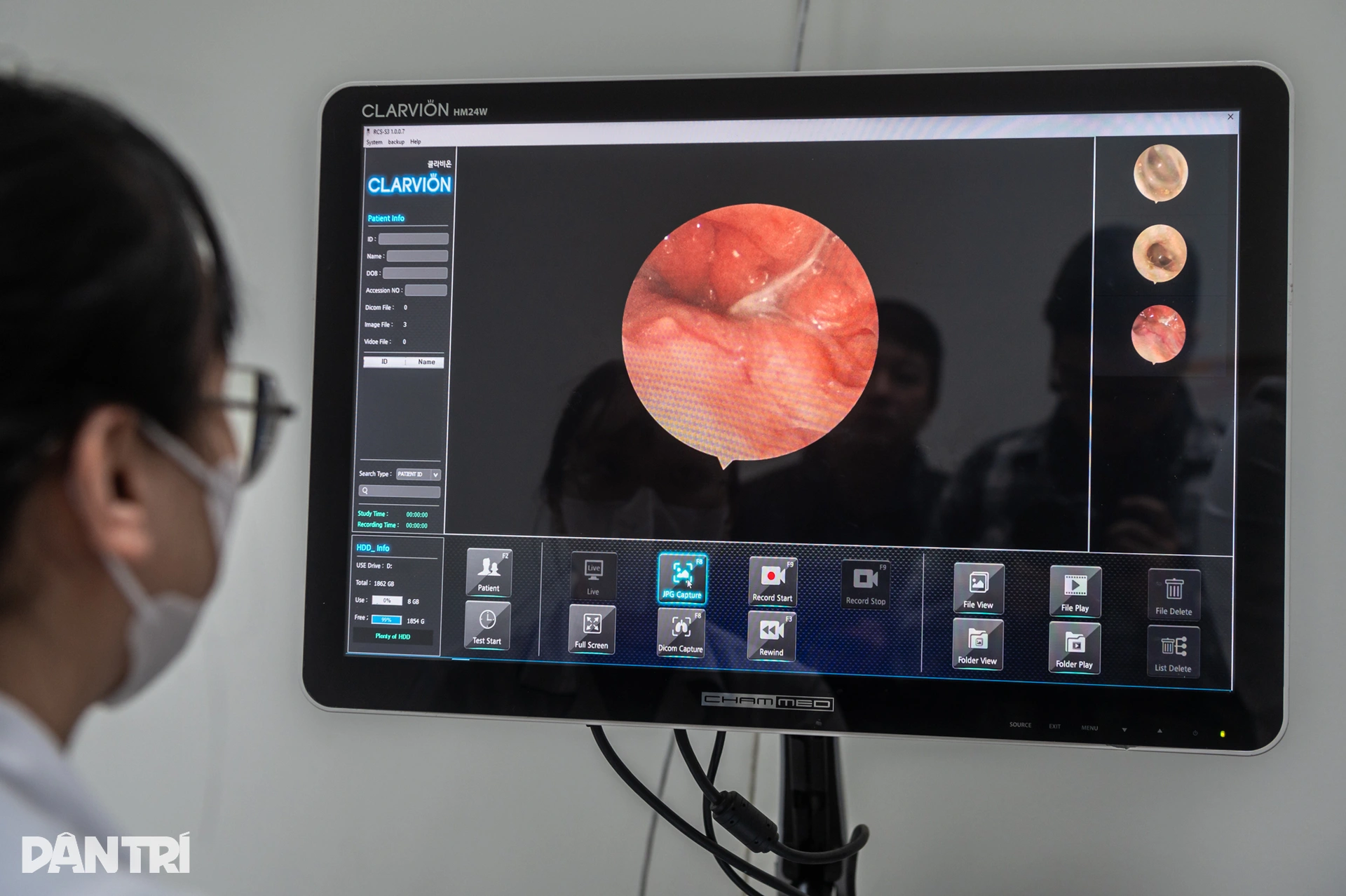 Bên trong khoang mũi sưng nề của người Hà Nội giữa cao điểm ô nhiễm - 6