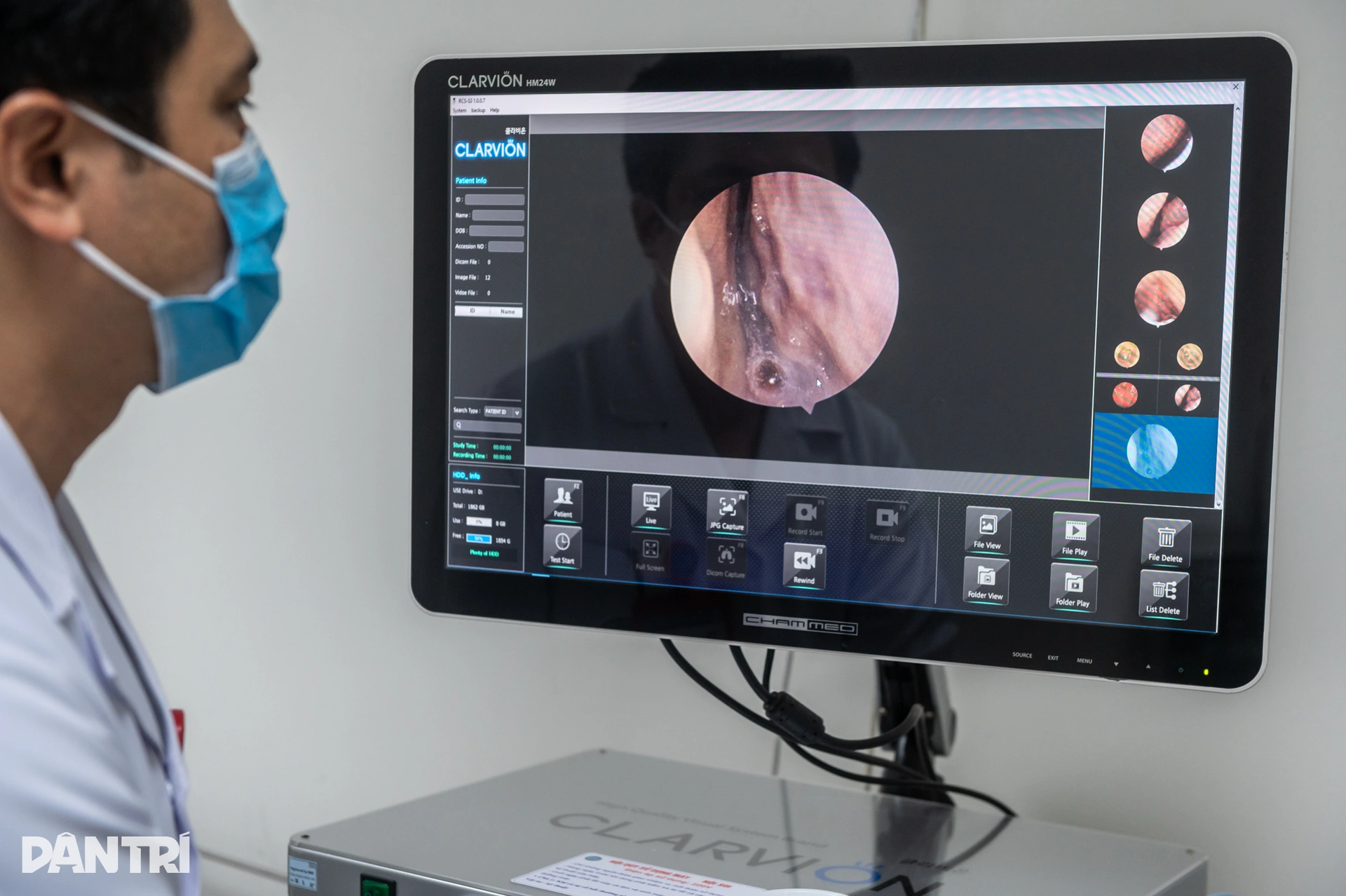 Bên trong khoang mũi sưng nề của người Hà Nội giữa cao điểm ô nhiễm - 3