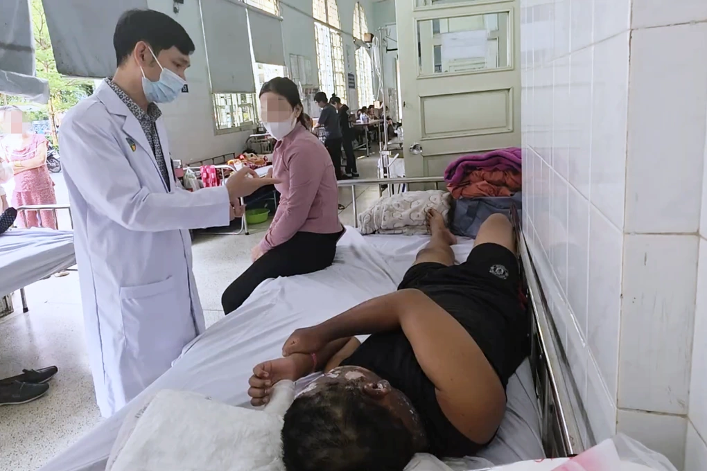 Thêm bé trai bị pháo nổ trúng mặt, chấn thương nặng trước Tết - 2