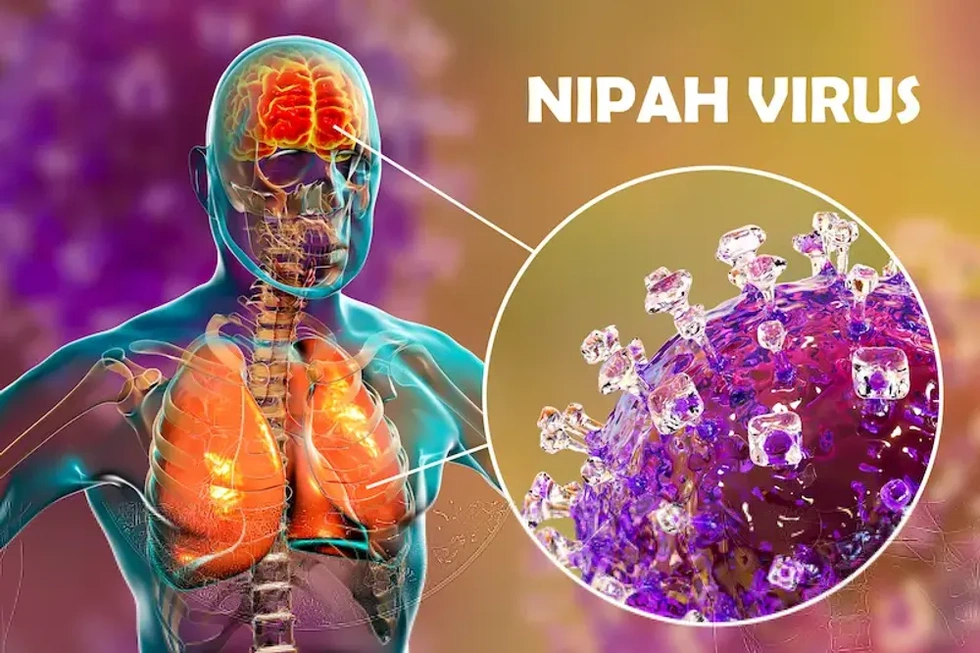 Những điều cần biết về loại virus Nipah nguy hiểm chết người - 2 Những điều cần biết về loại virus Nipah nguy hiểm chết người - 2