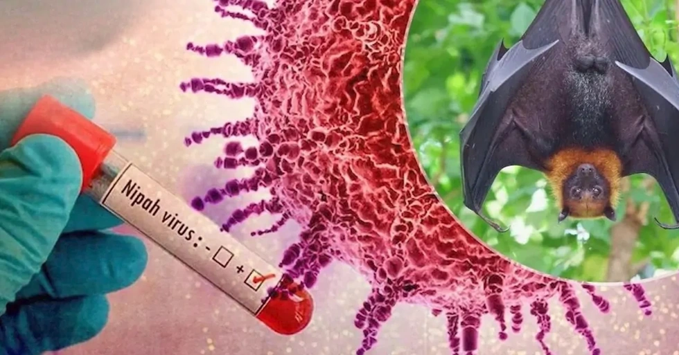 Virus Nipah đã từng bùng phát tại đâu, khiến bao nhiêu người thiệt mạng? - 5 Virus Nipah đã từng bùng phát tại đâu, khiến bao nhiêu người thiệt mạng? - 5