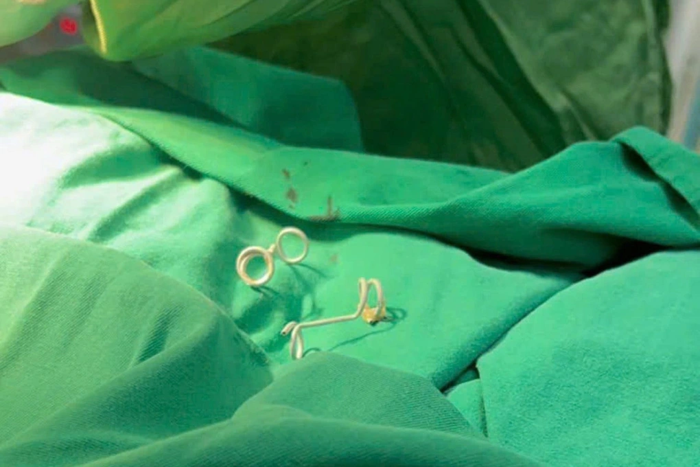 Can thiệp bào thai thành công, em bé mang “đôi cánh tí hon” chào đời - 2