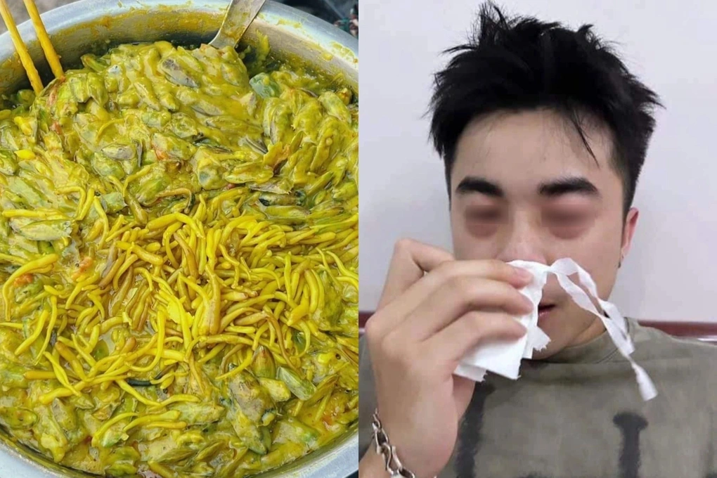 Chàng trai Hà Nội sưng mắt, khó thở vì món đặc sản khổ trước, sướng sau - 3 Chàng trai Hà Nội sưng mắt, khó thở vì món đặc sản khổ trước, sướng sau - 3