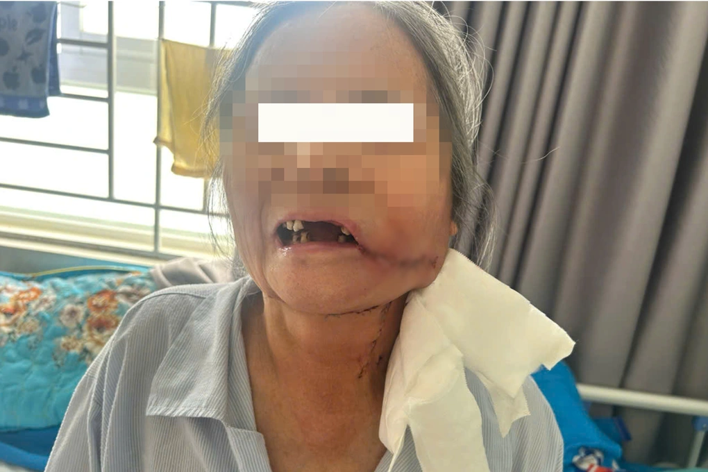 TPHCM: Cấp cứu cháu bé có khối u não to gấp ba lần chỉ trong 3 tháng - 3 TPHCM: Cấp cứu cháu bé có khối u não to gấp ba lần chỉ trong 3 tháng - 3