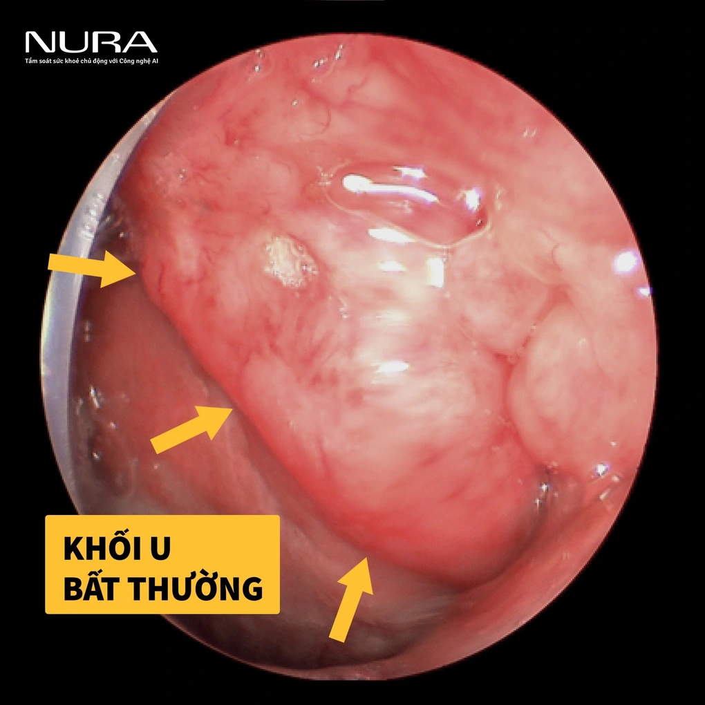 Chuẩn hóa toàn cầu, am hiểu bản địa: Mô hình tầm soát giúp phát hiện bệnh hiểm nghèo sớm - 2