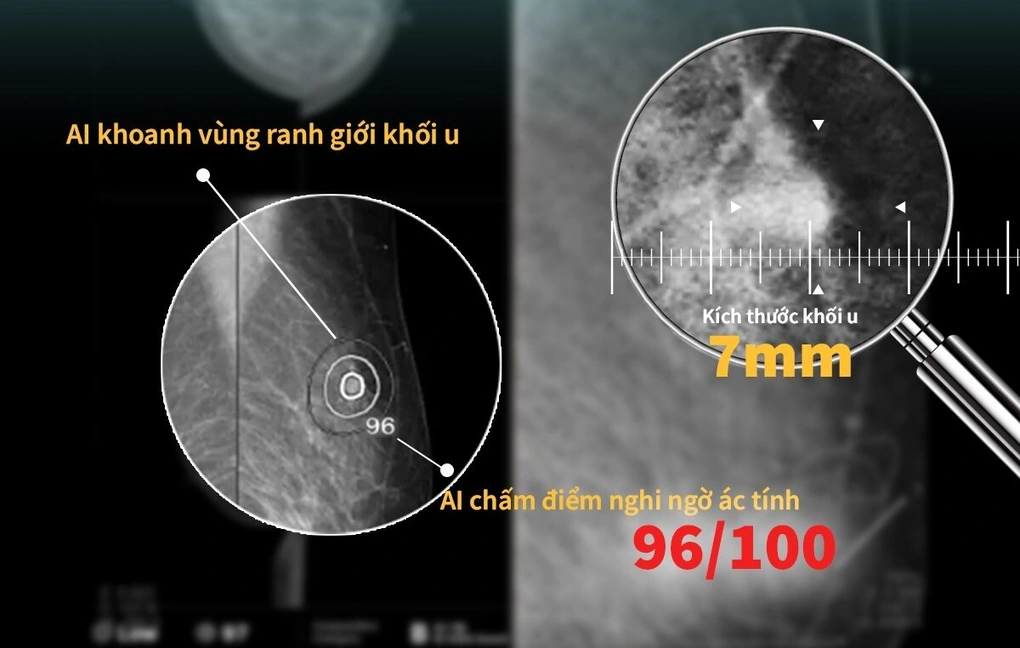 Chuẩn hóa toàn cầu, am hiểu bản địa: Mô hình tầm soát giúp phát hiện bệnh hiểm nghèo sớm - 3