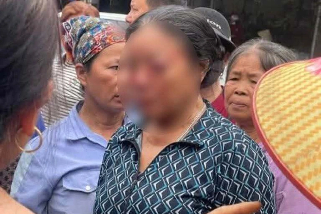 Nhân chứng kể phút người phụ nữ bán rau bị xịt nước áp lực cao vào mặt - 2 Nhân chứng kể phút người phụ nữ bán rau bị xịt nước áp lực cao vào mặt - 2