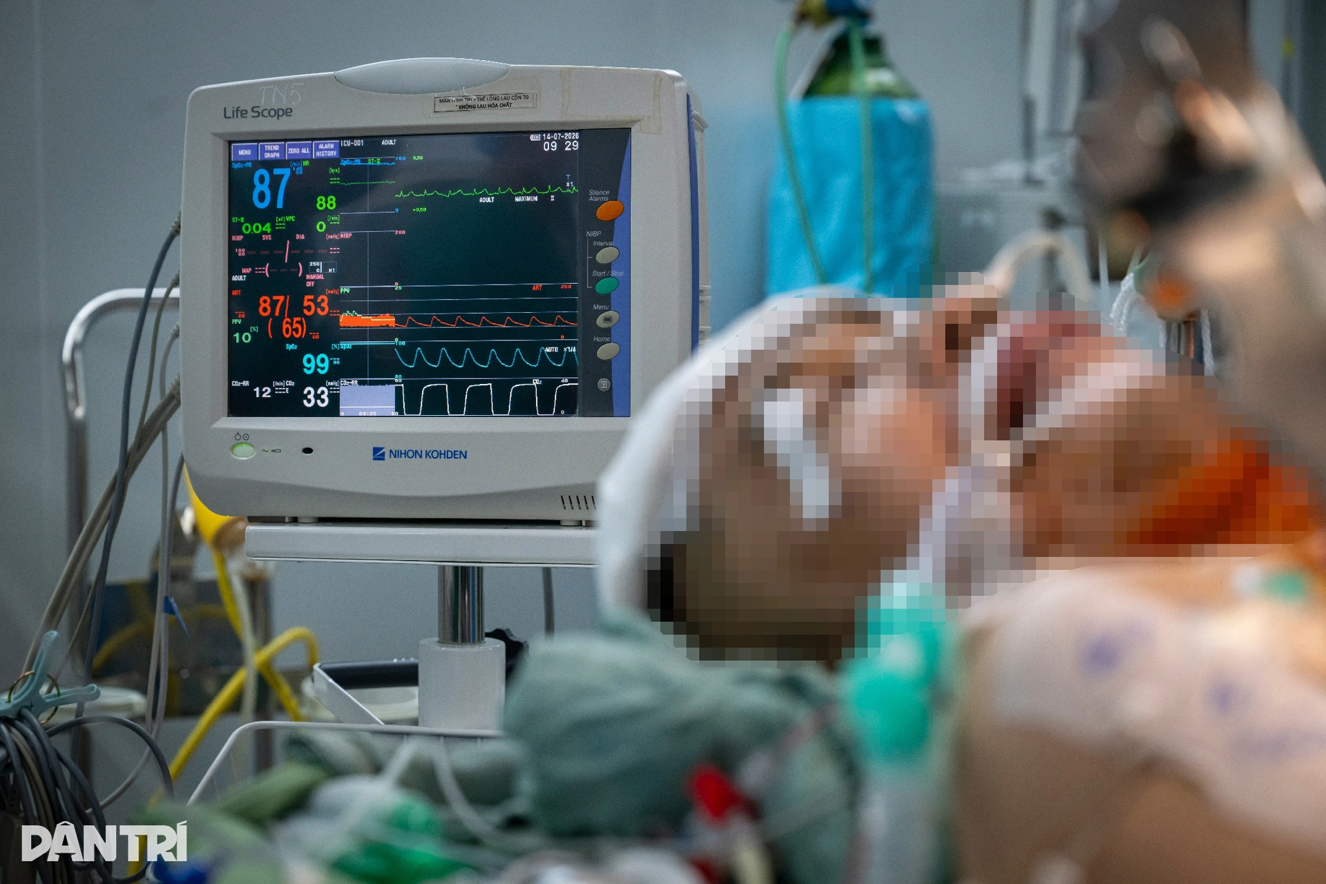 Người bố đơn thân chia đôi lá gan cứu 2 người lạ, gia đình bật khóc tự hào - 7 Người bố đơn thân chia đôi lá gan cứu 2 người lạ, gia đình bật khóc tự hào - 7