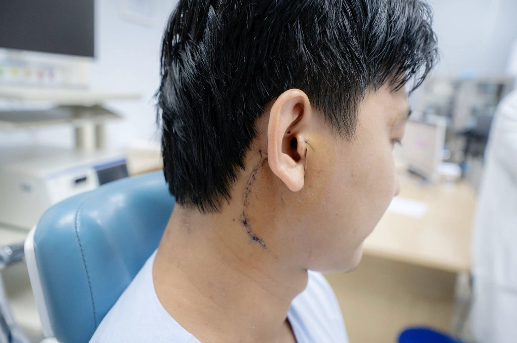 Sợ phẫu thuật liệt mặt, chàng trai mang khối u lớn sang Việt Nam cầu cứu - 2 Sợ phẫu thuật liệt mặt, chàng trai mang khối u lớn sang Việt Nam cầu cứu - 2